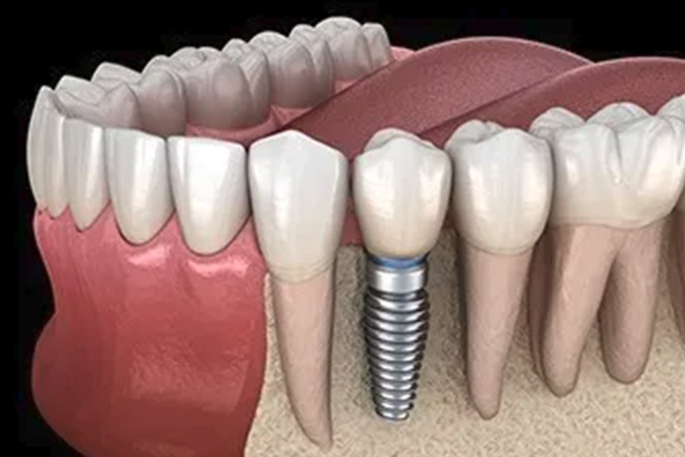 包括的歯科治療