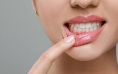 歯周病が進むとどんな症状が出るの？