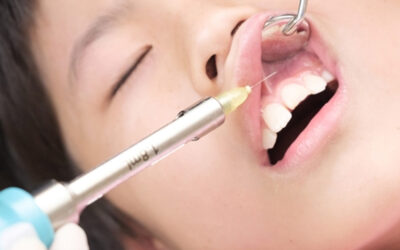 歯ぐきが腫れる原因ってなに？