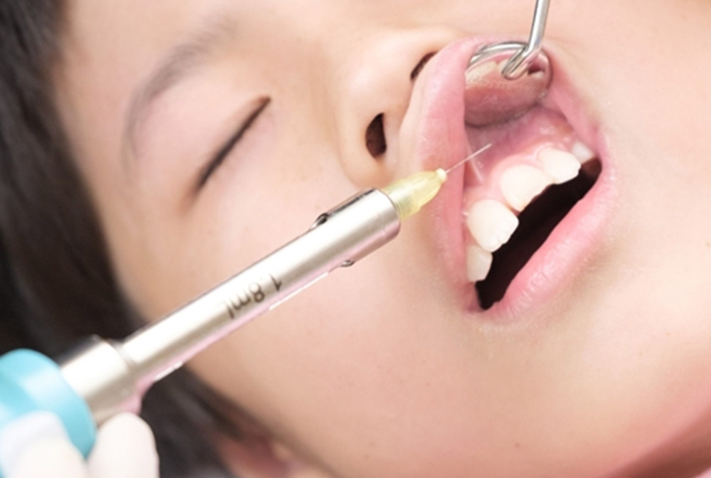 電動麻酔注射器の使用